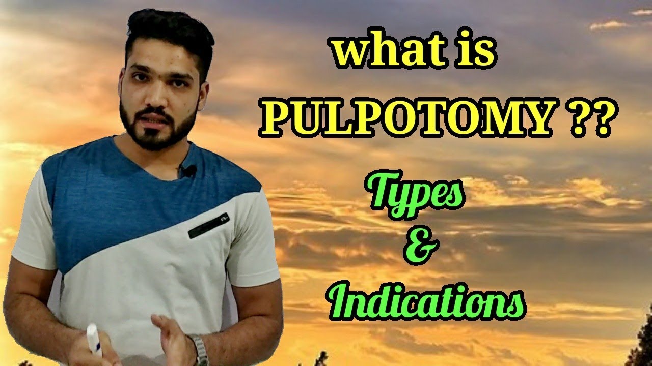 Pulpotomy, Indications & types | which material used in pulpotomy ?