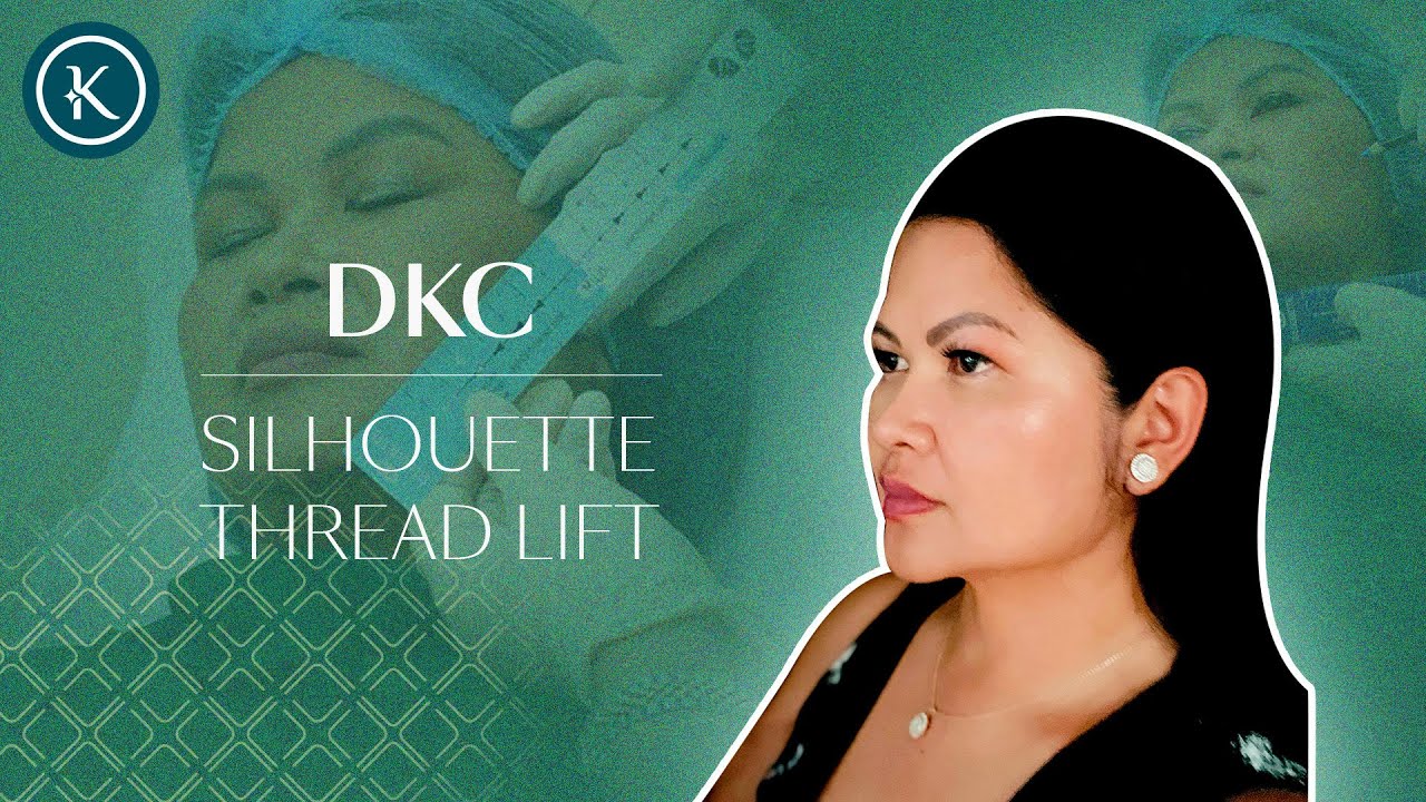 Silhouette Thread | A Non-Surgical Face Lifting Procedure