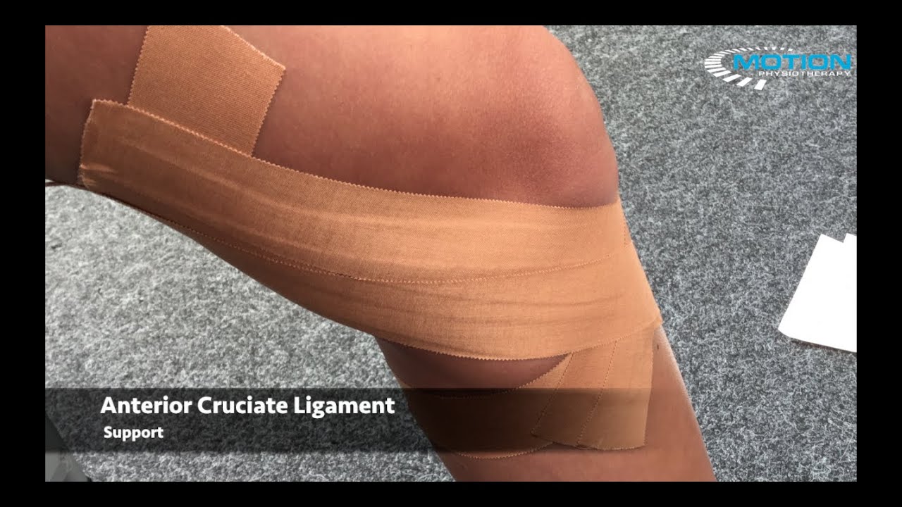 How to tape a knee - ACL / anterior cruciate ligament sprain - sports taping series