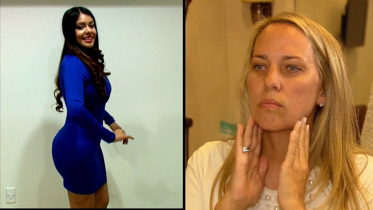 Unusual Reasons People Got Plastic Surgery