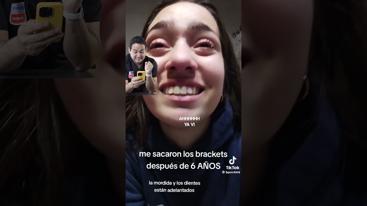 NO COMETAS ESE ERROR 🚫 BRACKETS SIN EXTRACCIONES