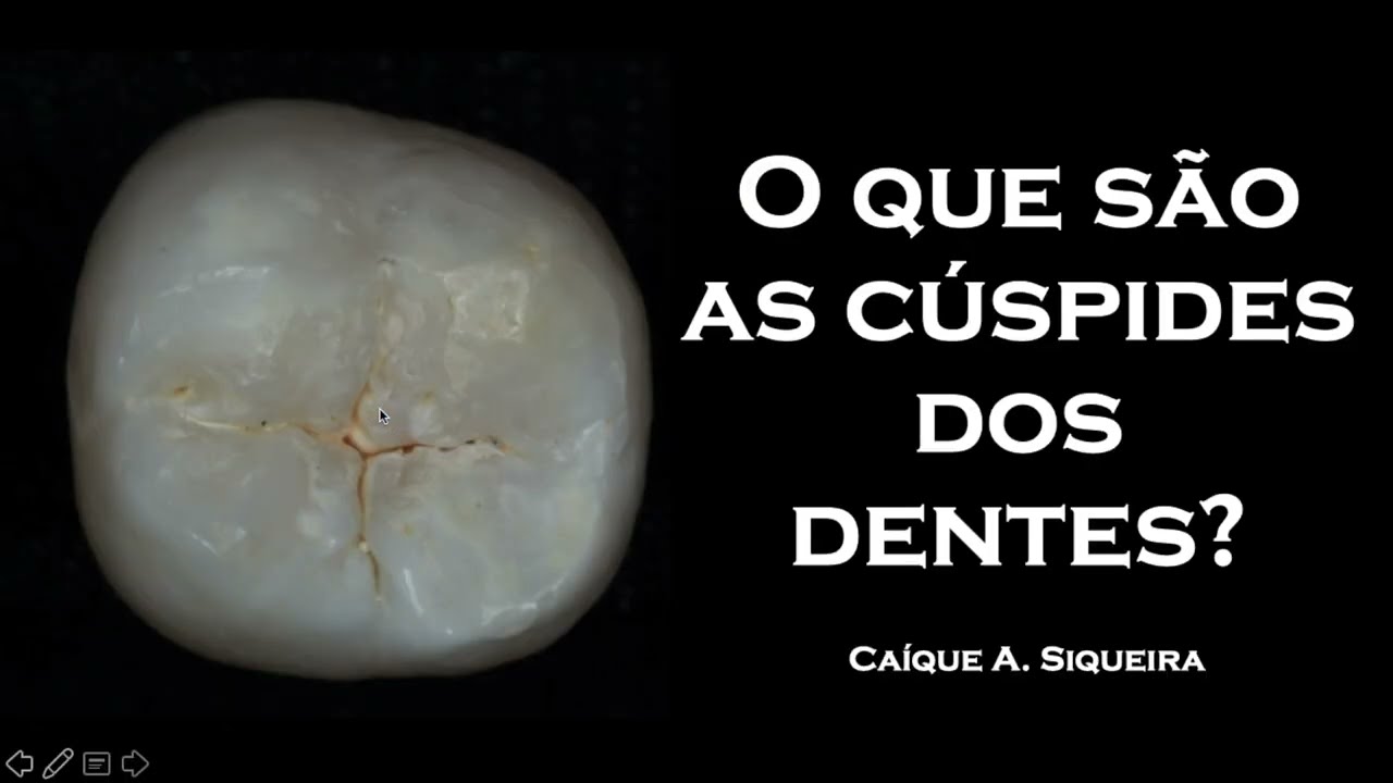 O que são as cúspides dos dentes? | Anatomia Dental