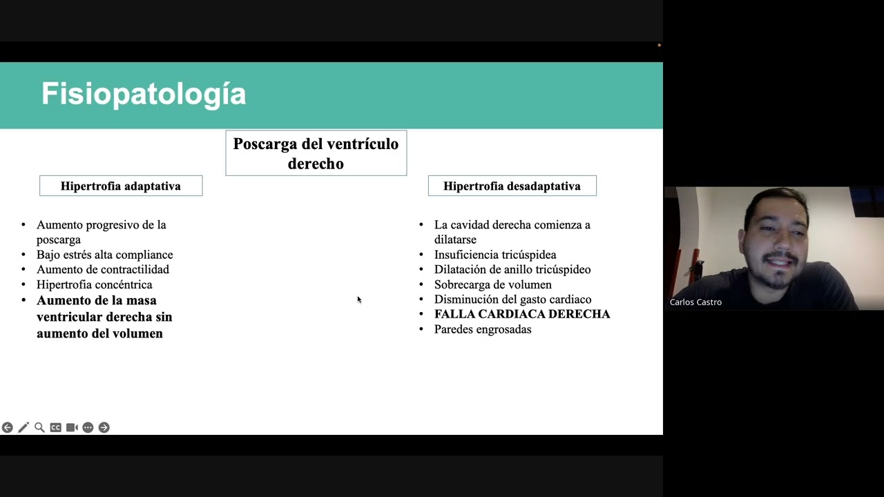 Hipertensión pulmonar, abordaje guiado por ultrasonido POCUS.