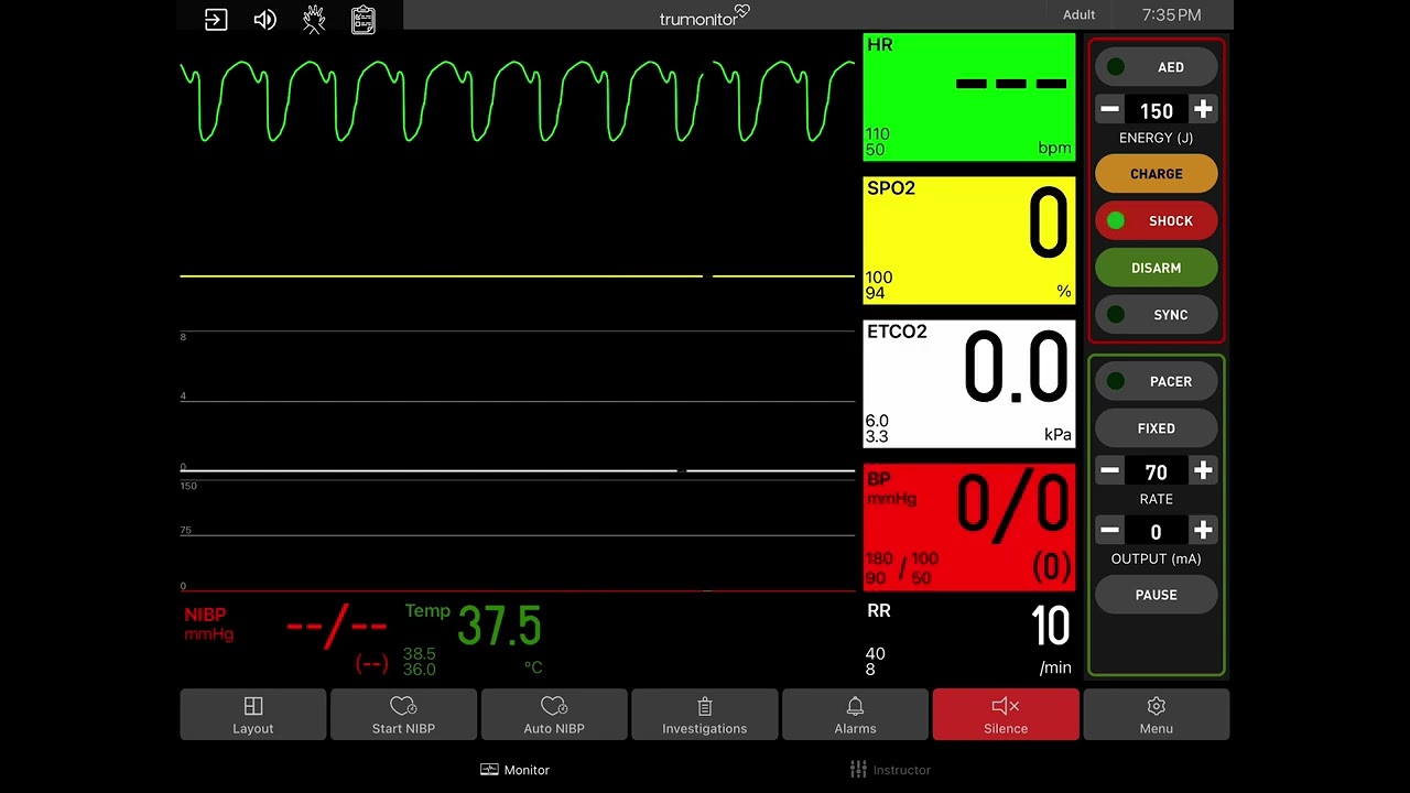 Pulseless Ventricular Tachycardia with Defibrillation