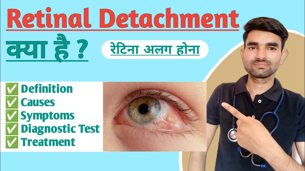 Retinal Detachment in Hindi | Causes, Symptoms and Treatment of Retinal Detachment A