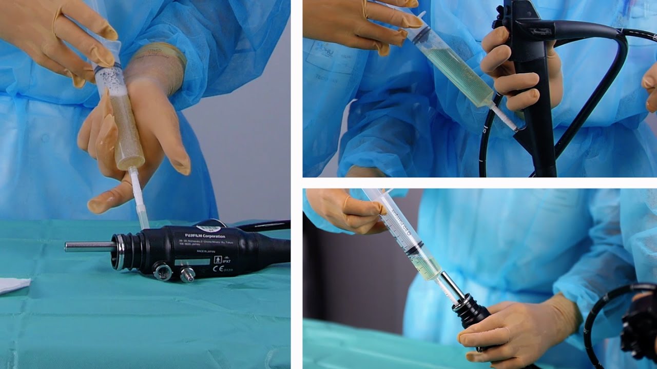 Les prélèvements d'environnement : sur endoscopes