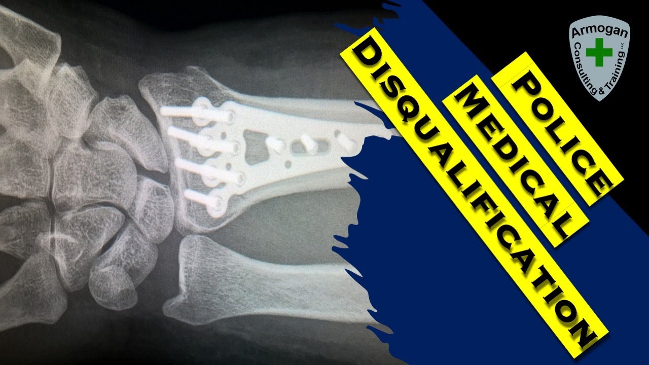Police Medical Disqualification