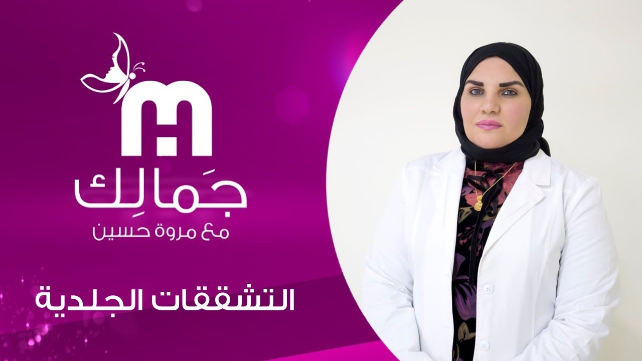 التشققات الجلدية | الحلقة 16 | جمالك مع مروة حسين
