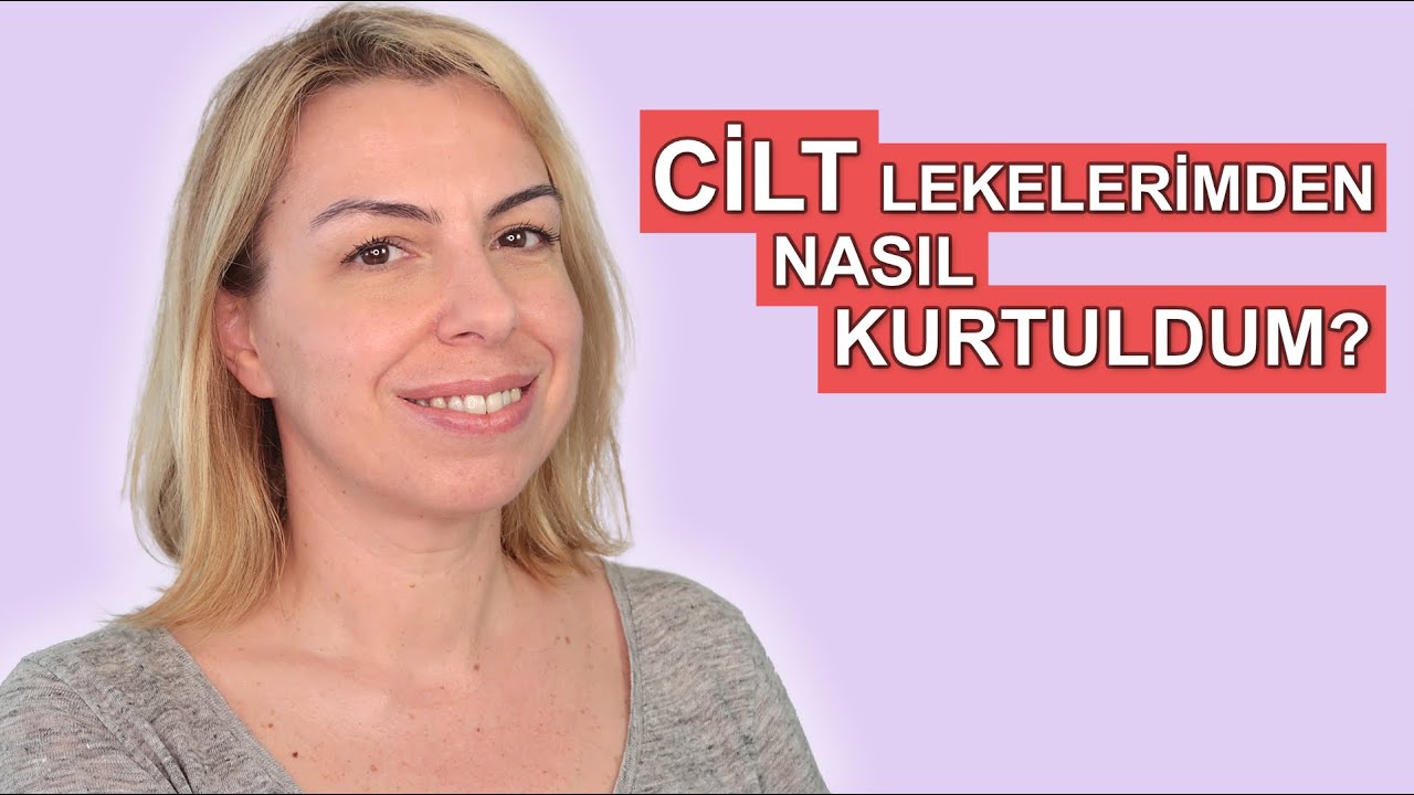 CİLT LEKELERİMDEN NASIL KURTULDUM?