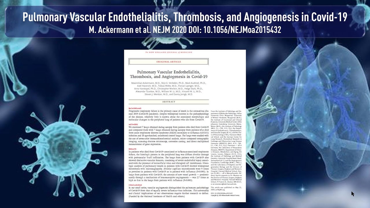 Endothelialitis, Mikrothrombose und Angiogenese: Warum SARS-CoV-2 die Lunge schädigt