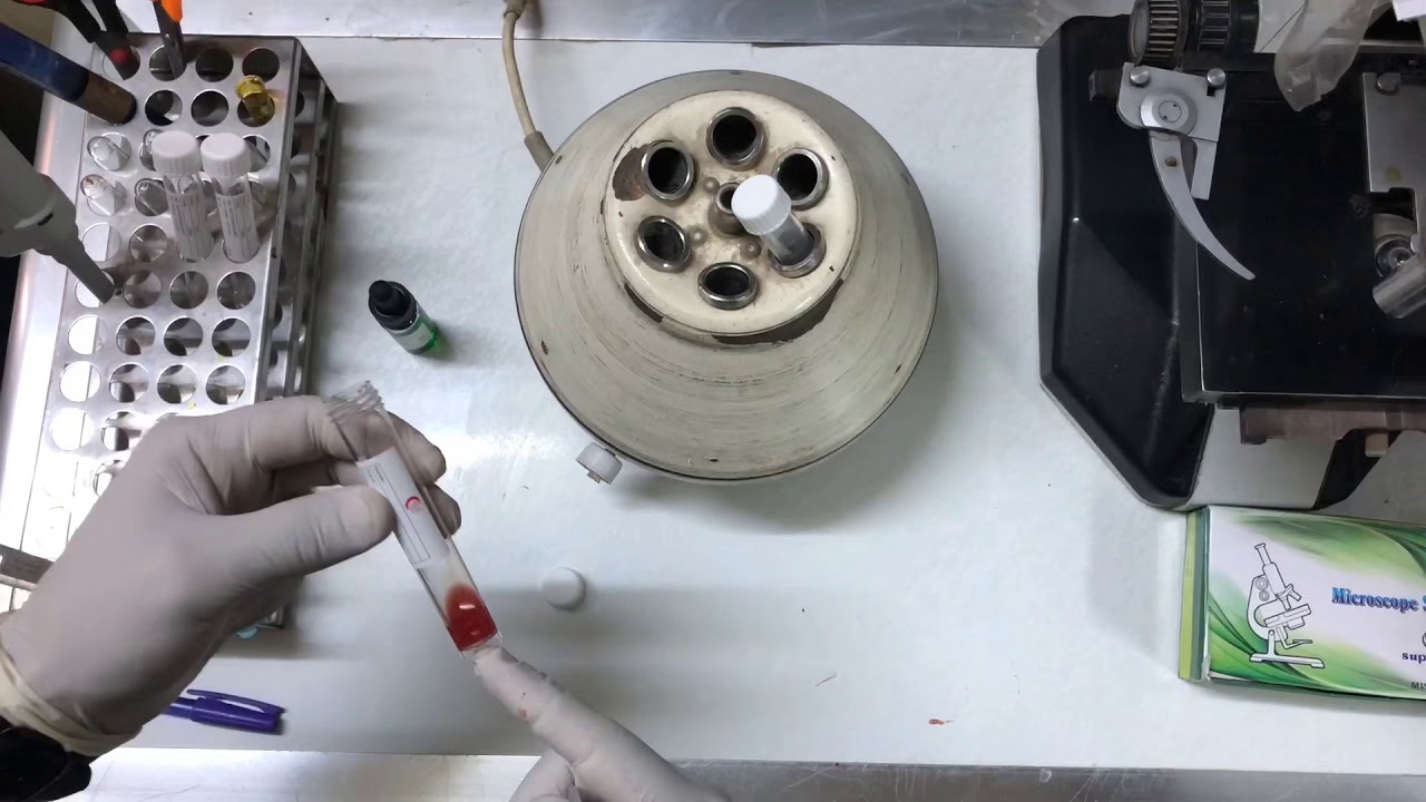 Direct Coombs test (الجزء الثالث بالتفصيل) مع كيفيه تحضير العالق ، تطبيق عملي للجزء الثاني.