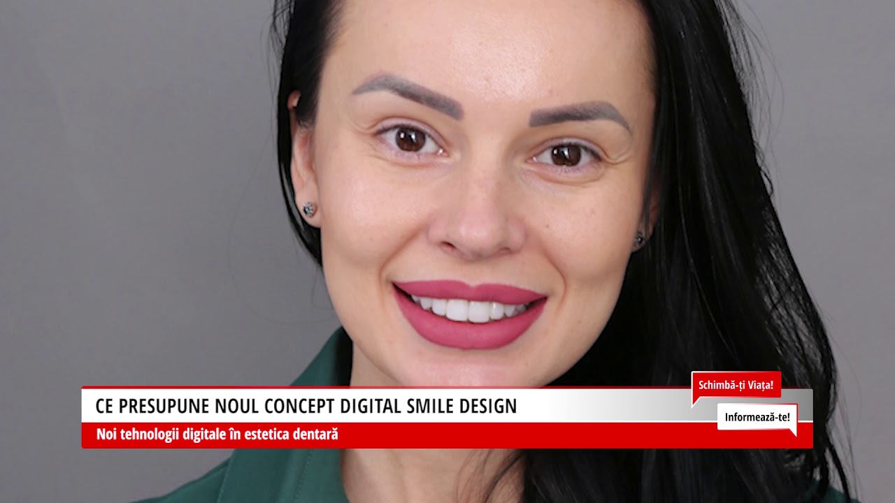 Fatete dentare cu ajutorul DSD (Digital Smile Design) || Tehnologiile digitale in estetica B1TV