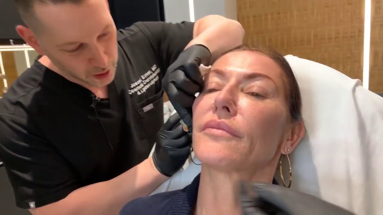 Sculptra | Collagen-Stimulating Injections | West Hollywood, CA | Dr. Jason Emer