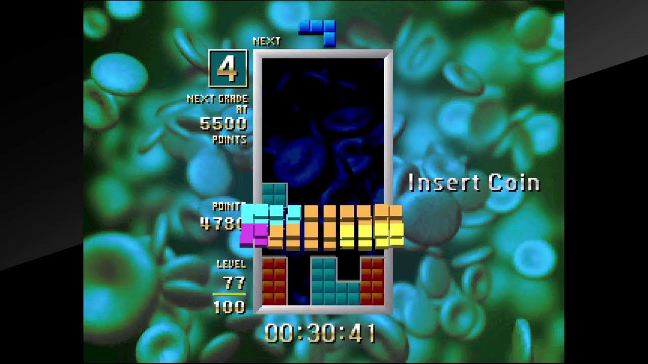 30分ビグテト(TGM1)　2026/03/04