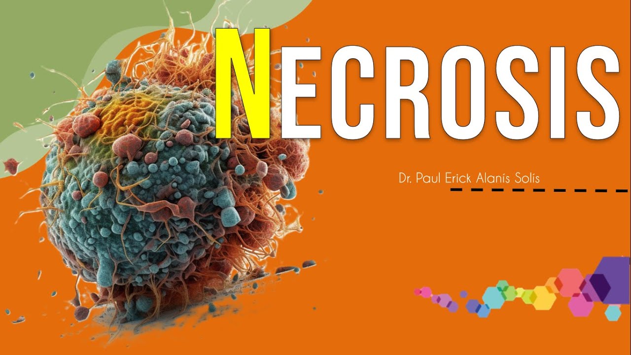 ¿Qué es la Necrosis?