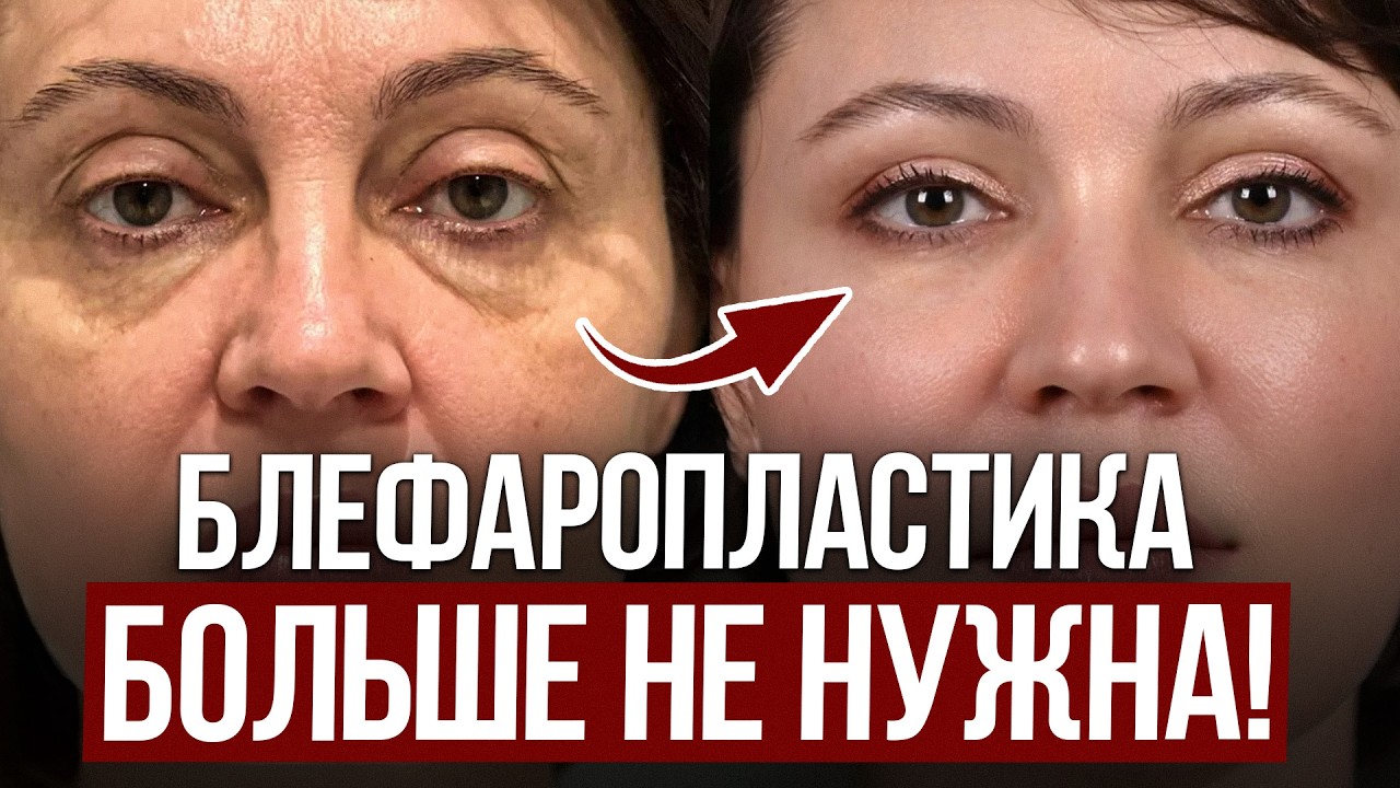 НАТУРАЛЬНЫЙ способ ухода за зоной вокруг глаз! / Как БЫСТРО подтянуть кожу без врачей?