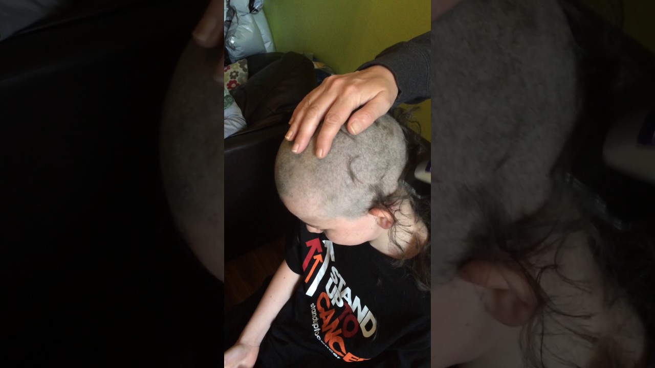 Ben going bald!