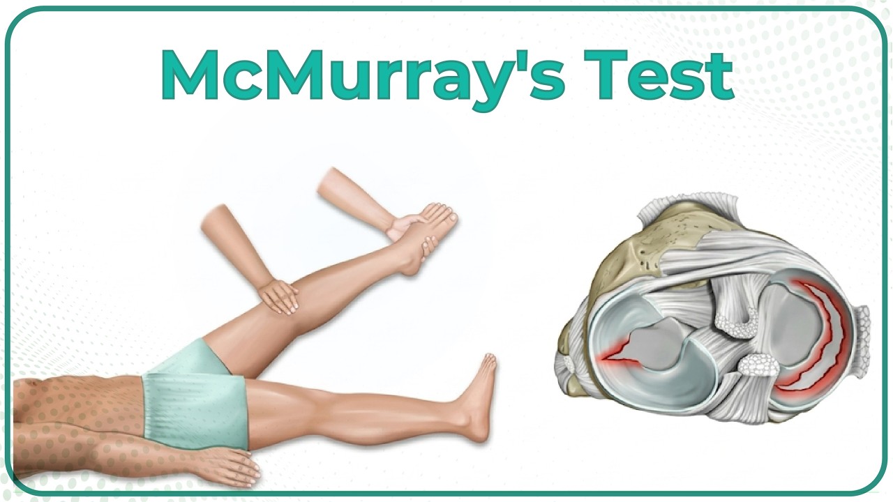 McMurray&rsquo;s Test for Meniscal Tear Animation: Clinical essentials - Dr G Bhanu Prakash