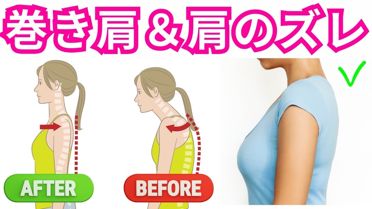 巻き肩・肩の不安定さの原因は、肩甲骨と上腕骨のズレです！