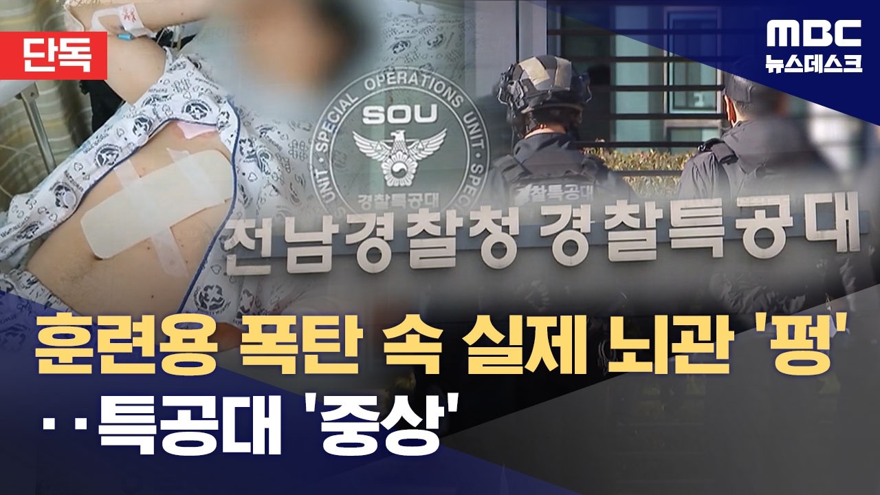 [단독] 훈련 중 폭발 사고‥중상 입은 순경에 