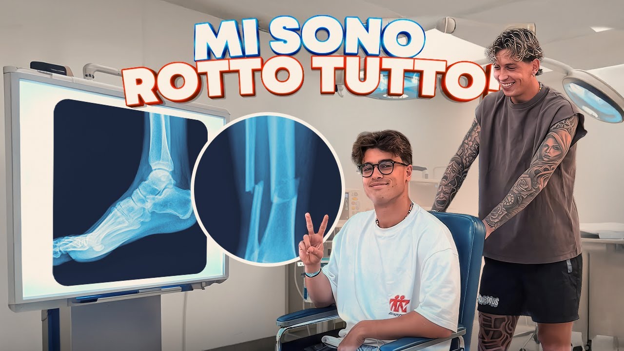 MI SONO ROTTO TUTTO! *vacanza in puglia