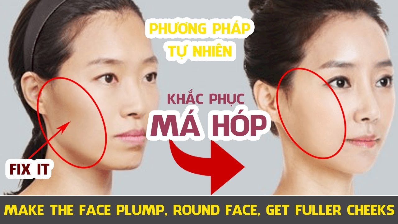 Khắc Phục Má Hóp, Mặt Gầy Làm Cho Khuôn Mặt Trở Nên Đầy Đặn Trẻ Trung Hơn.