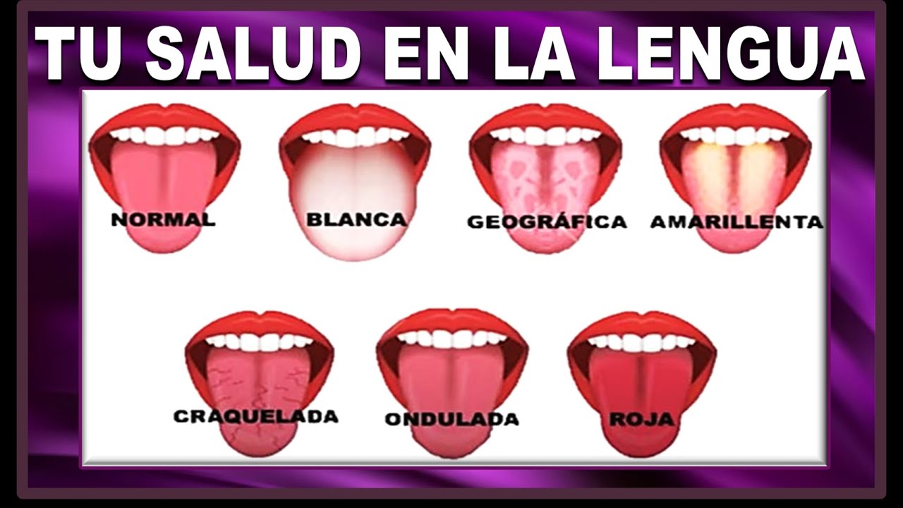 Señales en la lengua que no debes ignorar