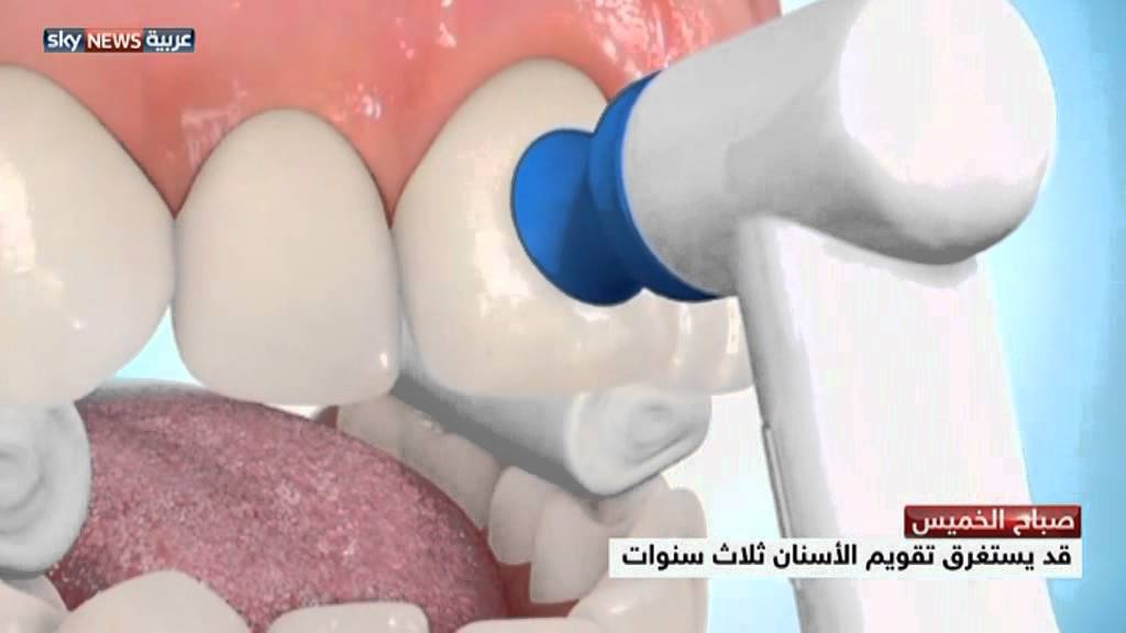 نصائح حول تقويم أسنان الأطفال