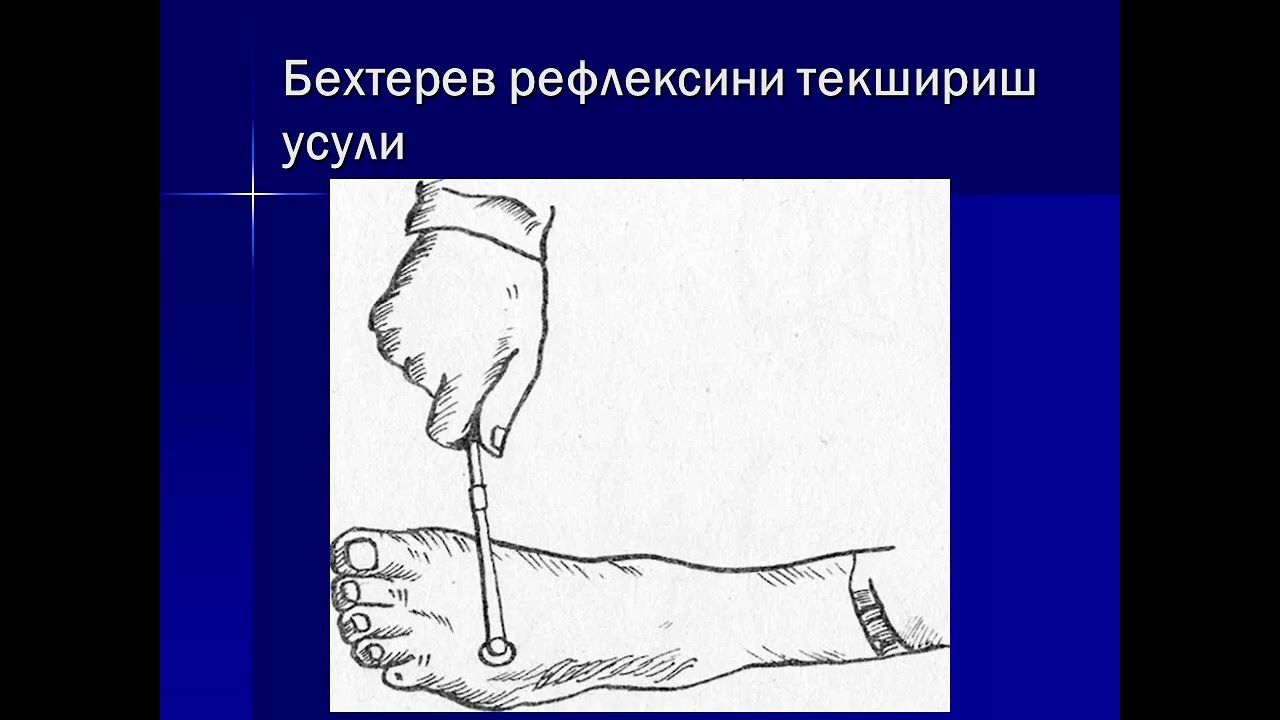 Ixtiyoriy harakat tizimi