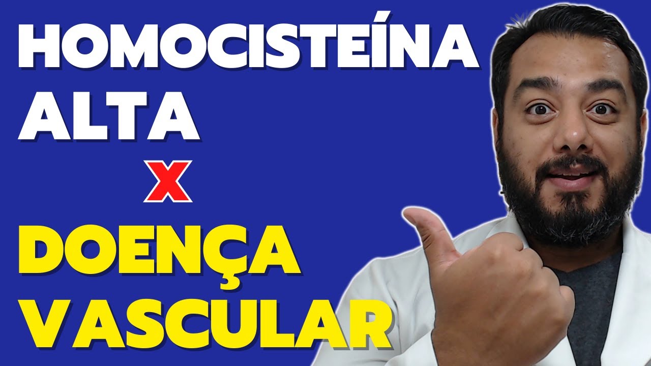 Homocisteína Alta e doenças cardiovasculares: entenda essa relação preocupante! - Dr. Victor Proença