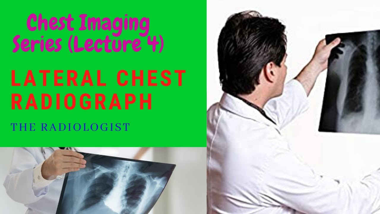 LATERAL CHEST RADIOGRAPH #CHEST IMAGING SERIES (LECTURE 4)  #CHESTX-RAY #CHESTX-RAYBASICS