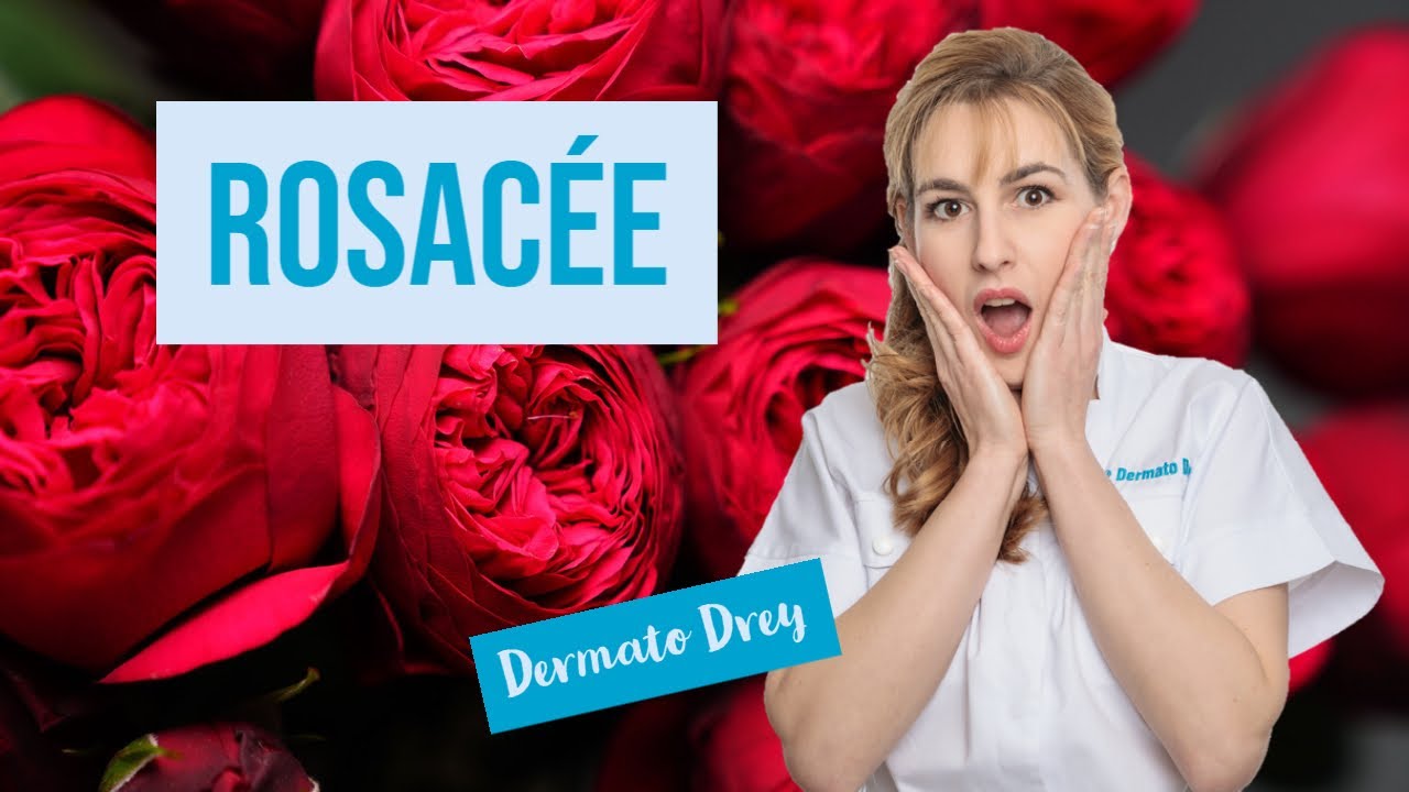 La rosacée ! Boutons et rougeurs du visage... #DermatoDrey