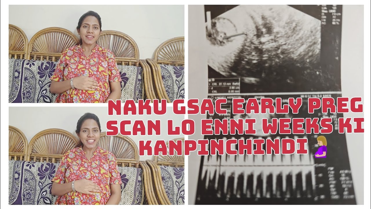 Early Pregnancy🤰🏼 Scan lo G-Sac kanpadakapothe Miscarriage avtunda? #longvideo #watchtillend #vlog