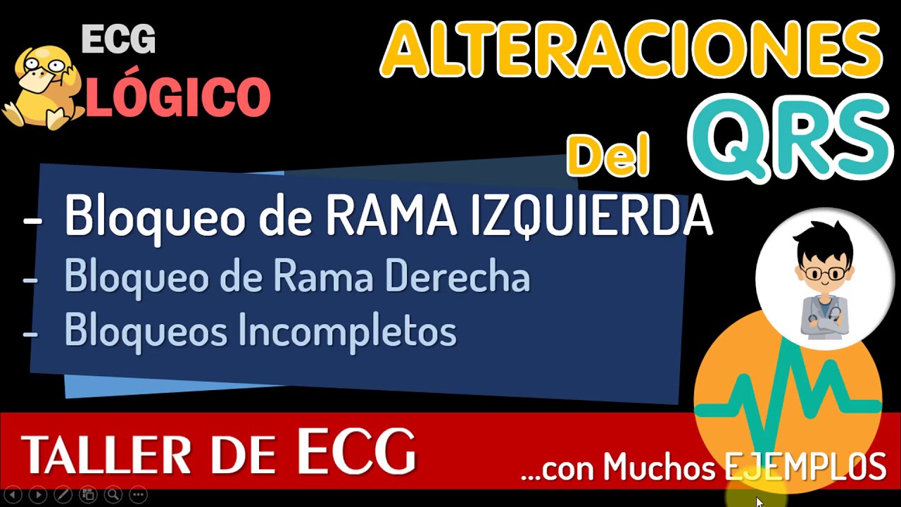 BLOQUEO COMPLETO e incompleto DE RAMA IZQUIERDA BCRI, CASOS CLINICOS, EJERCICIOS