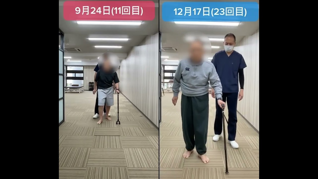 脊髄梗塞/発症2年/60代男性｜対麻痺からの“歩行レベルアップ”に挑んだ改善事例②  