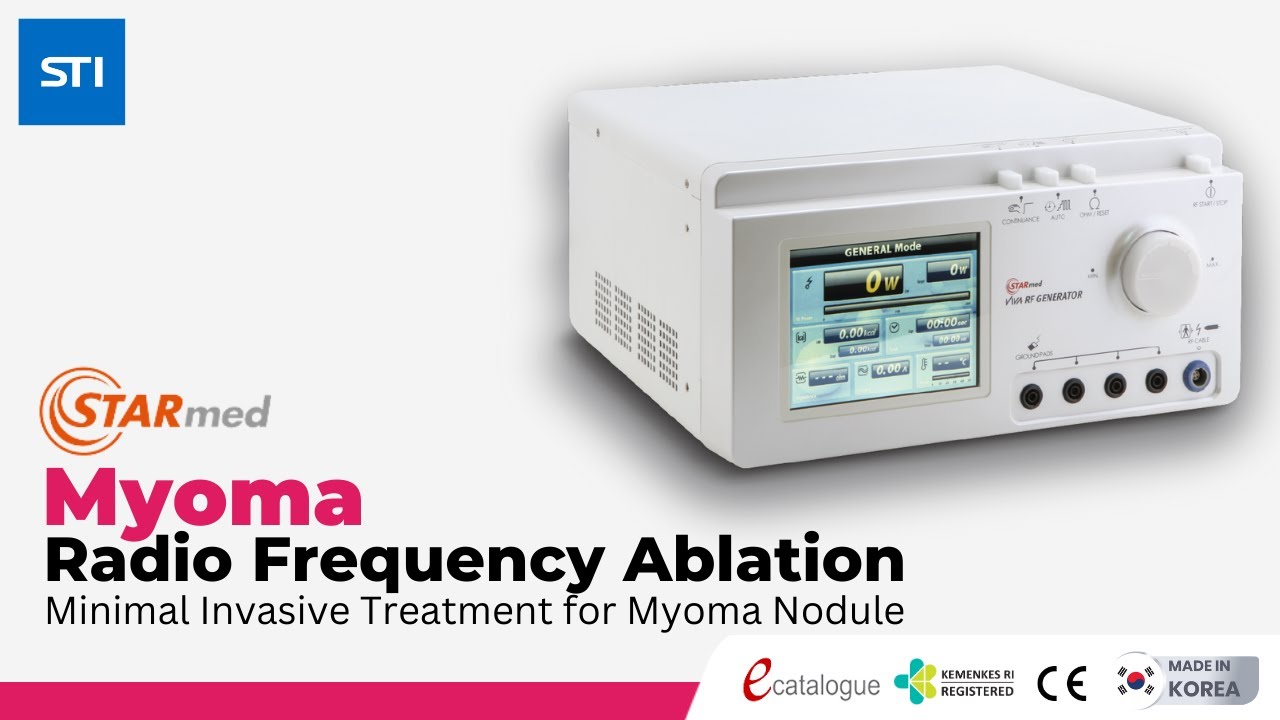 Myoma Radiofrequency Ablation