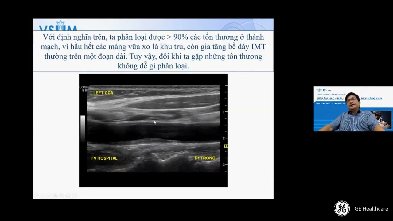 [CME SAMM] 2.2 Siêu âm khảo sát bề dày phức hợp nội-trung mạc động mạch cảnh - BS Nguyễn Quang Trọng