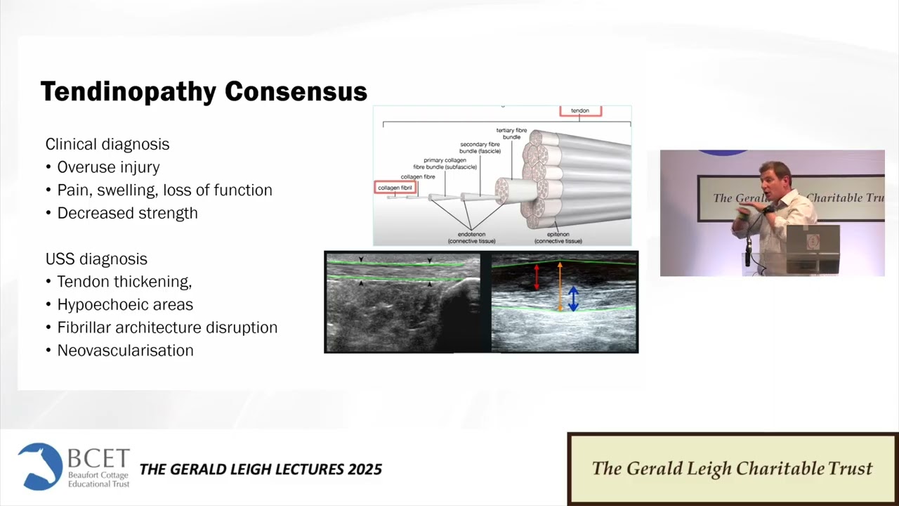 Tendinopathy Thinking old & new: The Human Perspective - Lt. Col. Tom Clack