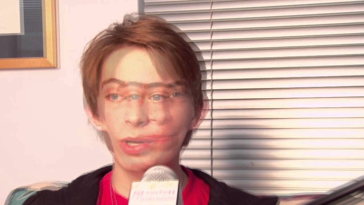 Dylan Riley Snyder discusses being in Tarzan on Broadway