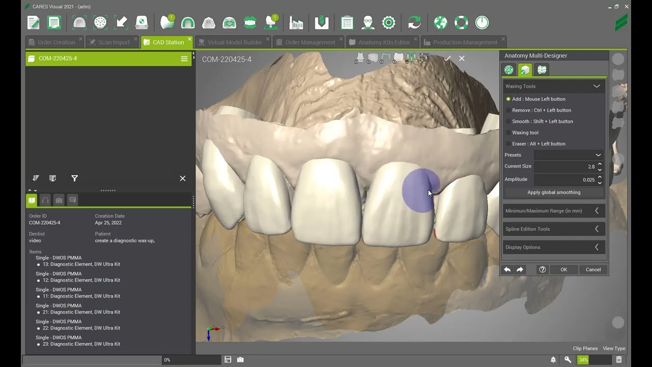 DWOS - Create a diagnostic wax up