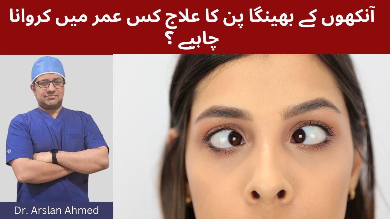Squint Eye Treatment in Lahore Pakistan | Aankhon ke bhengapan ka ilaj | Best eye Specialist Lahore