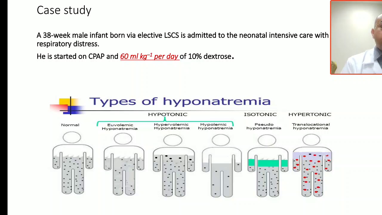 Case 62 how to adjust fluid in neonatal hyponatremia?fluid management of hyponatremia