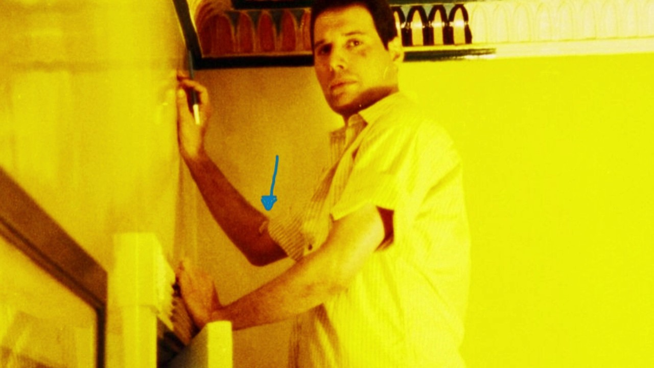 Freddie Mercury Undergoes an HIV Blood Test after Budapest & the Magic Tour (April 1987)