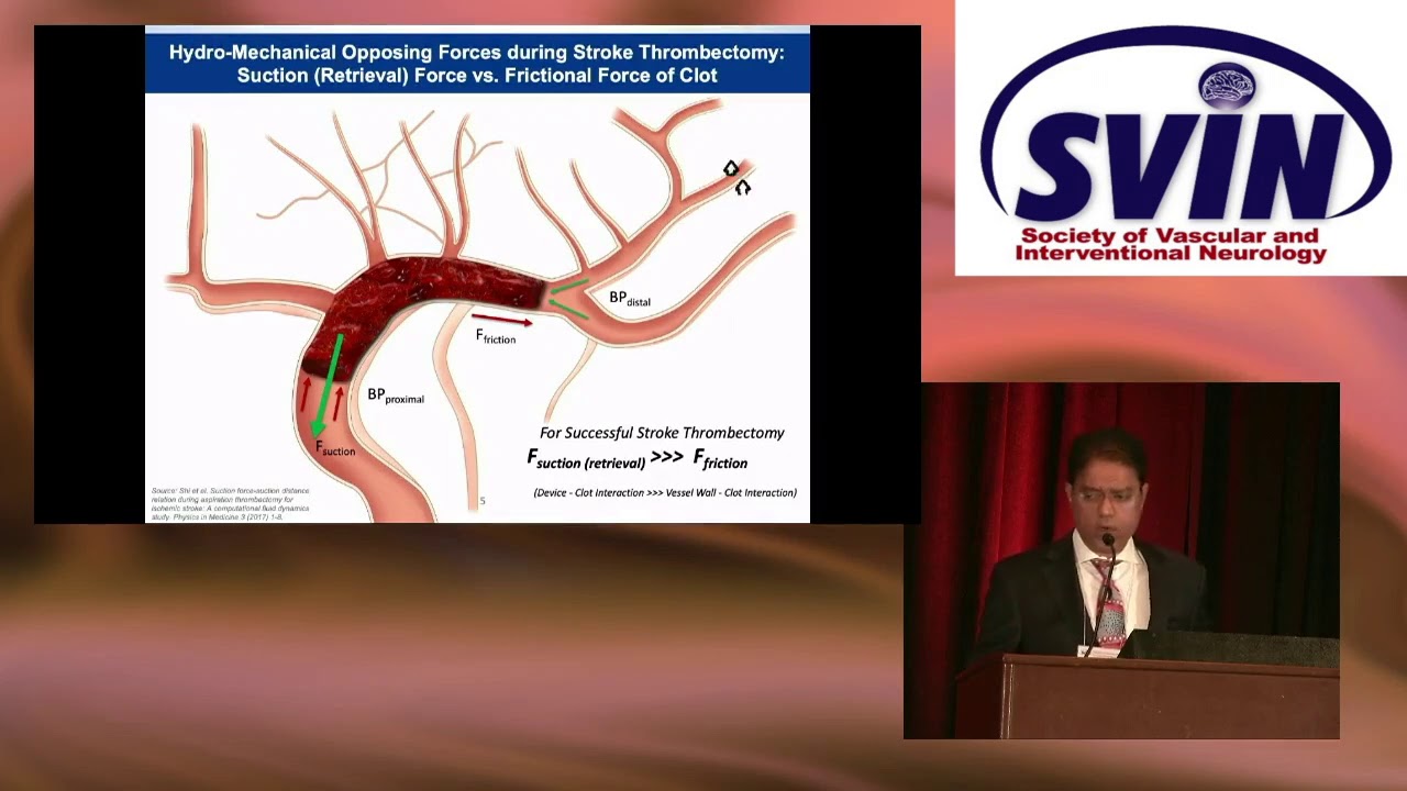 Future Stroke Thrombectomy Devices - Promise of Cyclical Aspiration