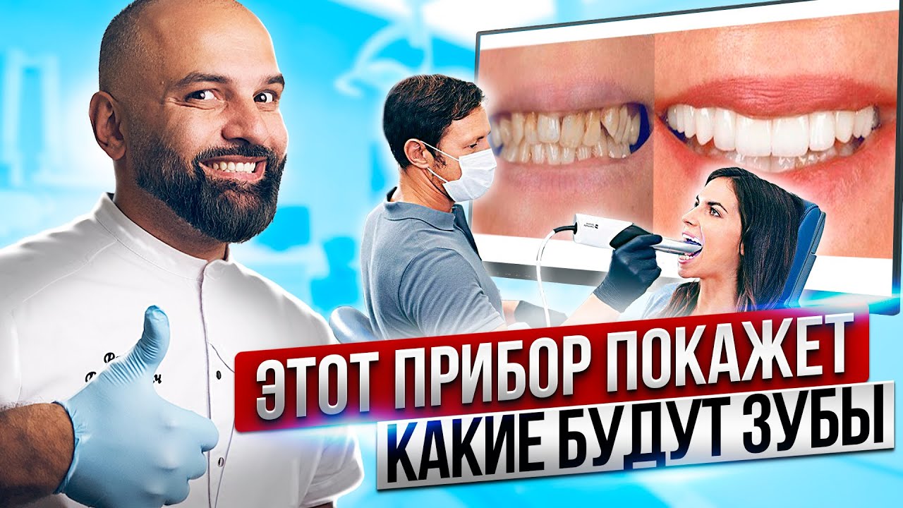 ЛИЦЕВОЙ СКАНЕР покажет твою БУДУЩУЮ УЛЫБКУ всего ЗА 10 МИНУТ. Искусственный Интеллект в стоматологии