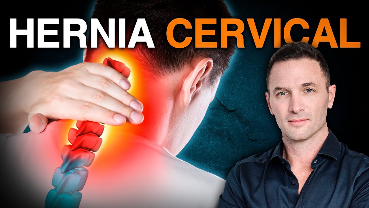¿Dolor de Cuello o Cabeza?  Posible Hernia Cervical | Soluciones Efectivas ✅