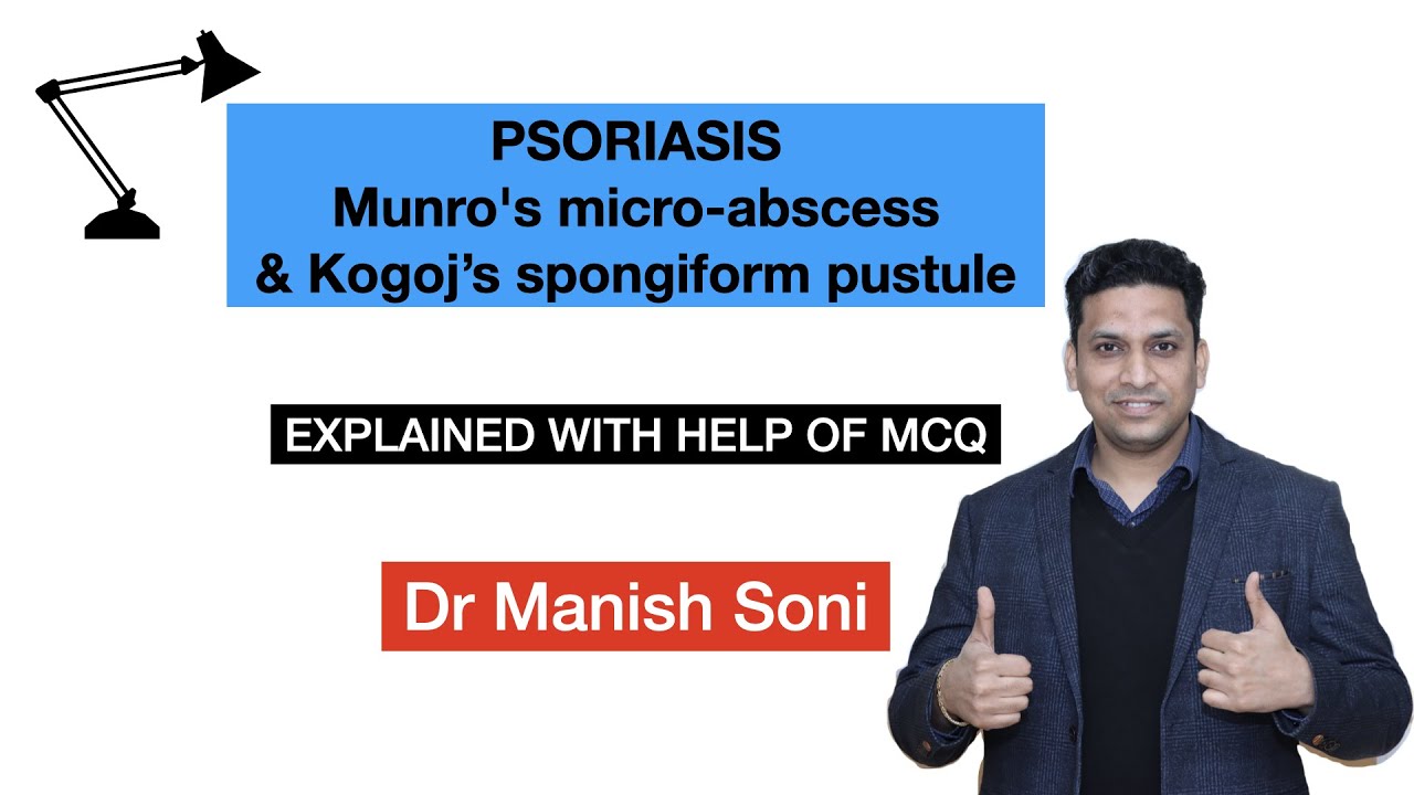 PSORIASIS: Munro's microabscess & Kogoj&rsquo;s spongiform pustule