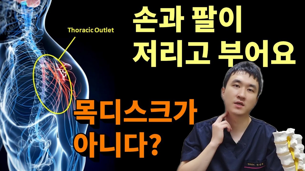 '팔저림' '손저림'을 풀어주는 목스트레칭! '흉곽출구증후군이란?' 원인 치료 목 스트레칭 총정리