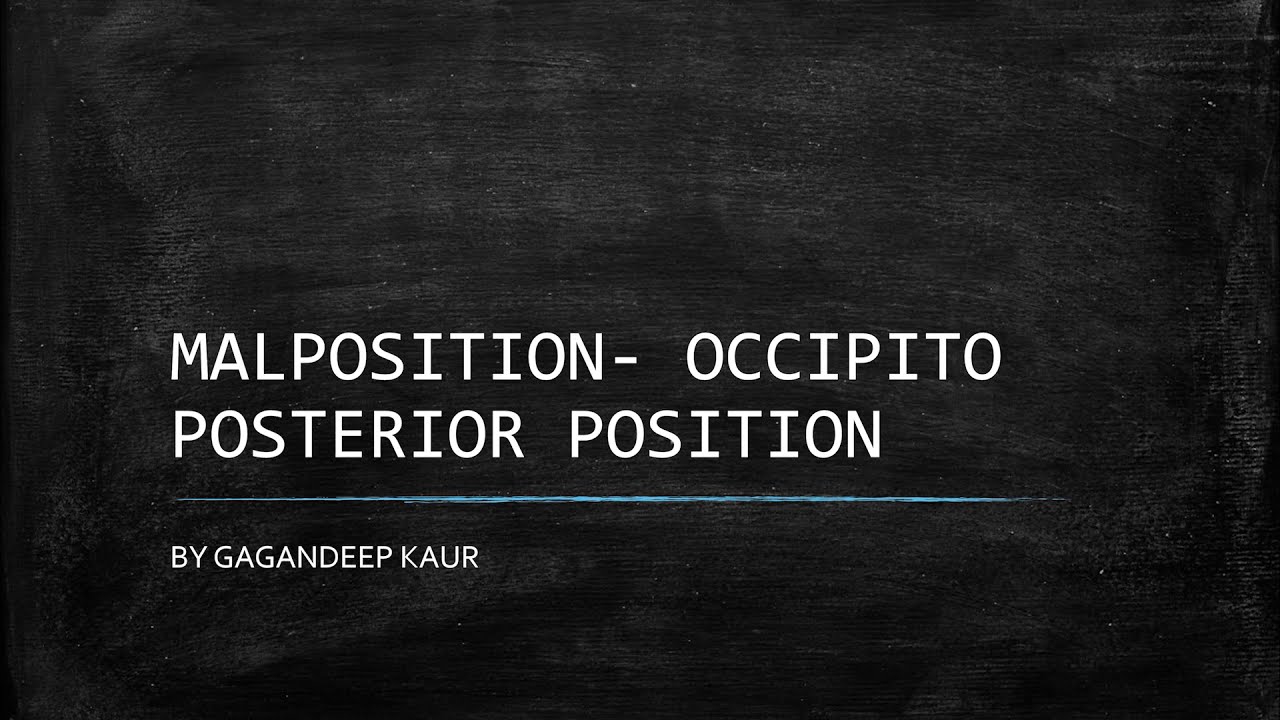 MALPOSITION- OCCIPITO POSTERIOR POSITION (Unit-8 OBG- Abnormal Labour)