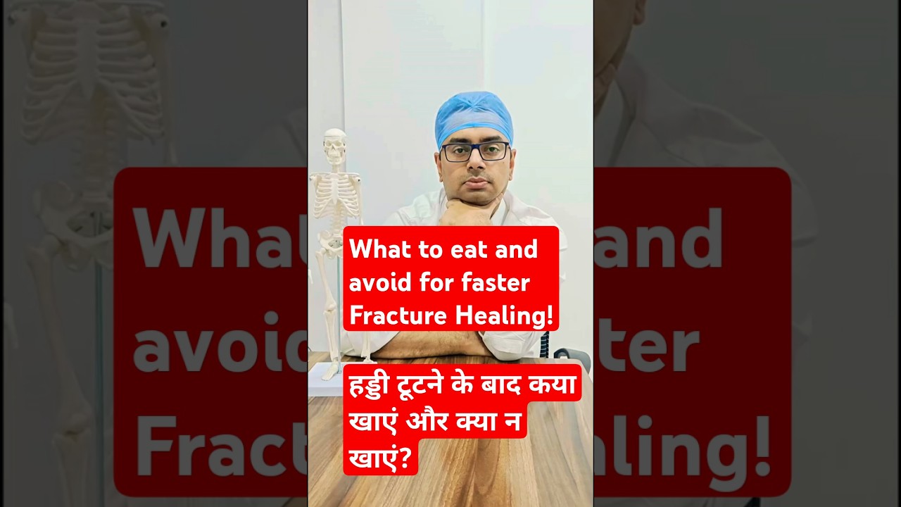 Foods to Eat & Avoid for Faster Fracture Healing/Broken Bones. #healthybones